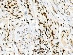 Phospho-RXRA (Ser260) Antibody in Immunohistochemistry (Paraffin) (IHC (P))