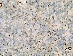 Phospho-RXRA (Ser260) Antibody in Immunohistochemistry (Paraffin) (IHC (P))