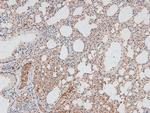 Phospho-CtBP1/CtBP2 (Ser158, Ser164) Antibody in Immunohistochemistry (Paraffin) (IHC (P))