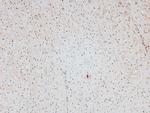 Phospho-CtBP1/CtBP2 (Ser158, Ser164) Antibody in Immunohistochemistry (Paraffin) (IHC (P))