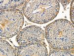 Phospho-MKP3 (Ser197) Antibody in Immunohistochemistry (Paraffin) (IHC (P))