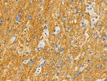 Phospho-MKP3 (Ser197) Antibody in Immunohistochemistry (Paraffin) (IHC (P))