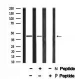 Phospho-MKP3 (Ser197) Antibody in Western Blot (WB)