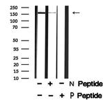 Phospho-LRP6 (Ser1490) Antibody in Western Blot (WB)