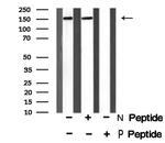 Phospho-Met (Tyr1365) Antibody in Western Blot (WB)