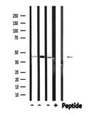 Phospho-HPD (Thr382) Antibody in Western Blot (WB)