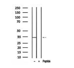 Phospho-KHK isoform A (Ser80) Antibody in Western Blot (WB)