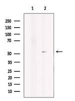 STK38/STK38L Antibody in Western Blot (WB)