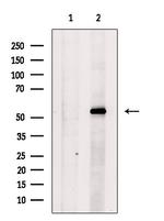 STK38/STK38L Antibody in Western Blot (WB)