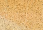 DACH1 Antibody in Immunohistochemistry (Paraffin) (IHC (P))