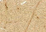 DACH1 Antibody in Immunohistochemistry (Paraffin) (IHC (P))