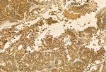 QSOX1 Antibody in Immunohistochemistry (Paraffin) (IHC (P))