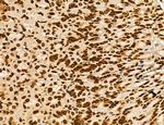 OGDH Antibody in Immunohistochemistry (Paraffin) (IHC (P))