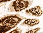 OGDH Antibody in Immunohistochemistry (Paraffin) (IHC (P))