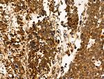 OGDH Antibody in Immunohistochemistry (Paraffin) (IHC (P))