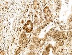 OGDH Antibody in Immunohistochemistry (Paraffin) (IHC (P))