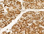 OGDH Antibody in Immunohistochemistry (Paraffin) (IHC (P))