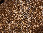 OGDH Antibody in Immunohistochemistry (Paraffin) (IHC (P))