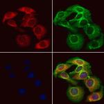 MTHFD2 Antibody in Immunocytochemistry (ICC/IF)