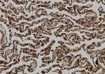 FAM96B Antibody in Immunohistochemistry (Paraffin) (IHC (P))