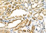 PDHB Antibody in Immunohistochemistry (Paraffin) (IHC (P))