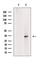 PDHB Antibody in Western Blot (WB)