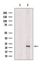 UBE2E2 Antibody in Western Blot (WB)