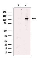 VPS11 Antibody in Western Blot (WB)