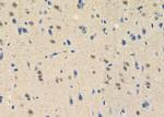 GTF2H1 Antibody in Immunohistochemistry (Paraffin) (IHC (P))