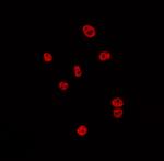 CSTF2 Antibody in Immunocytochemistry (ICC/IF)