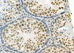 CSTF2 Antibody in Immunohistochemistry (Paraffin) (IHC (P))