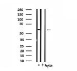 CSTF2 Antibody in Western Blot (WB)