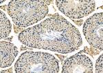 ADCK5 Antibody in Immunohistochemistry (Paraffin) (IHC (P))