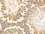 PARD3 Antibody in Immunohistochemistry (Paraffin) (IHC (P))