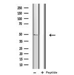 CYP4B1 Antibody in Western Blot (WB)