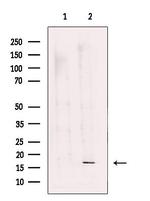 RPS18 Antibody in Western Blot (WB)