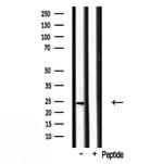 RPL17 Antibody in Western Blot (WB)