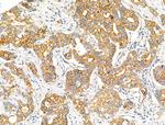 ACOT4 Antibody in Immunohistochemistry (Paraffin) (IHC (P))