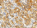 ACOT4 Antibody in Immunohistochemistry (Paraffin) (IHC (P))