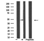 ACOT4 Antibody in Western Blot (WB)