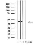 B4GALT1 Antibody in Western Blot (WB)