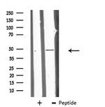 CHST10 Antibody in Western Blot (WB)