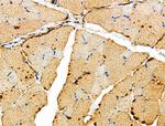 MRPL39 Antibody in Immunohistochemistry (Paraffin) (IHC (P))