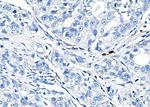 RAB38 Antibody in Immunohistochemistry (Paraffin) (IHC (P))