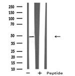 GPRC5B Antibody in Western Blot (WB)