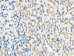 STAR Antibody in Immunohistochemistry (Paraffin) (IHC (P))