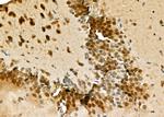 HSP701L Antibody in Immunohistochemistry (Paraffin) (IHC (P))