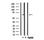 E-selectin Antibody in Western Blot (WB)