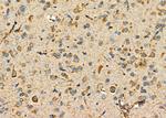 P2Y6 Antibody in Immunohistochemistry (Paraffin) (IHC (P))