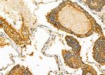 ACP5 Antibody in Immunohistochemistry (Paraffin) (IHC (P))